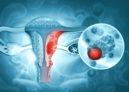 Cervical Cancer Awareness & Prevention