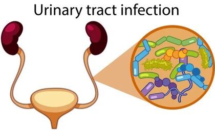 Warning Signs of Urinary Tract Infection (UTI)