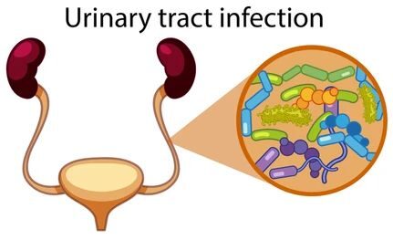 Warning Signs of Urinary Tract Infection (UTI)