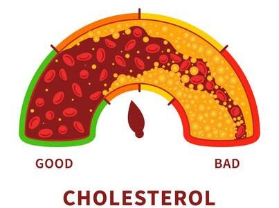 Cholesterol: Good vs Bad Cholesterol Explained