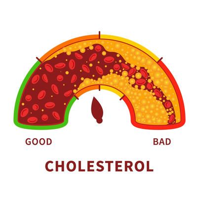 Cholesterol: Good vs Bad Cholesterol Explained