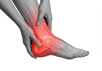 How Obesity Affects Bone & Joint Health